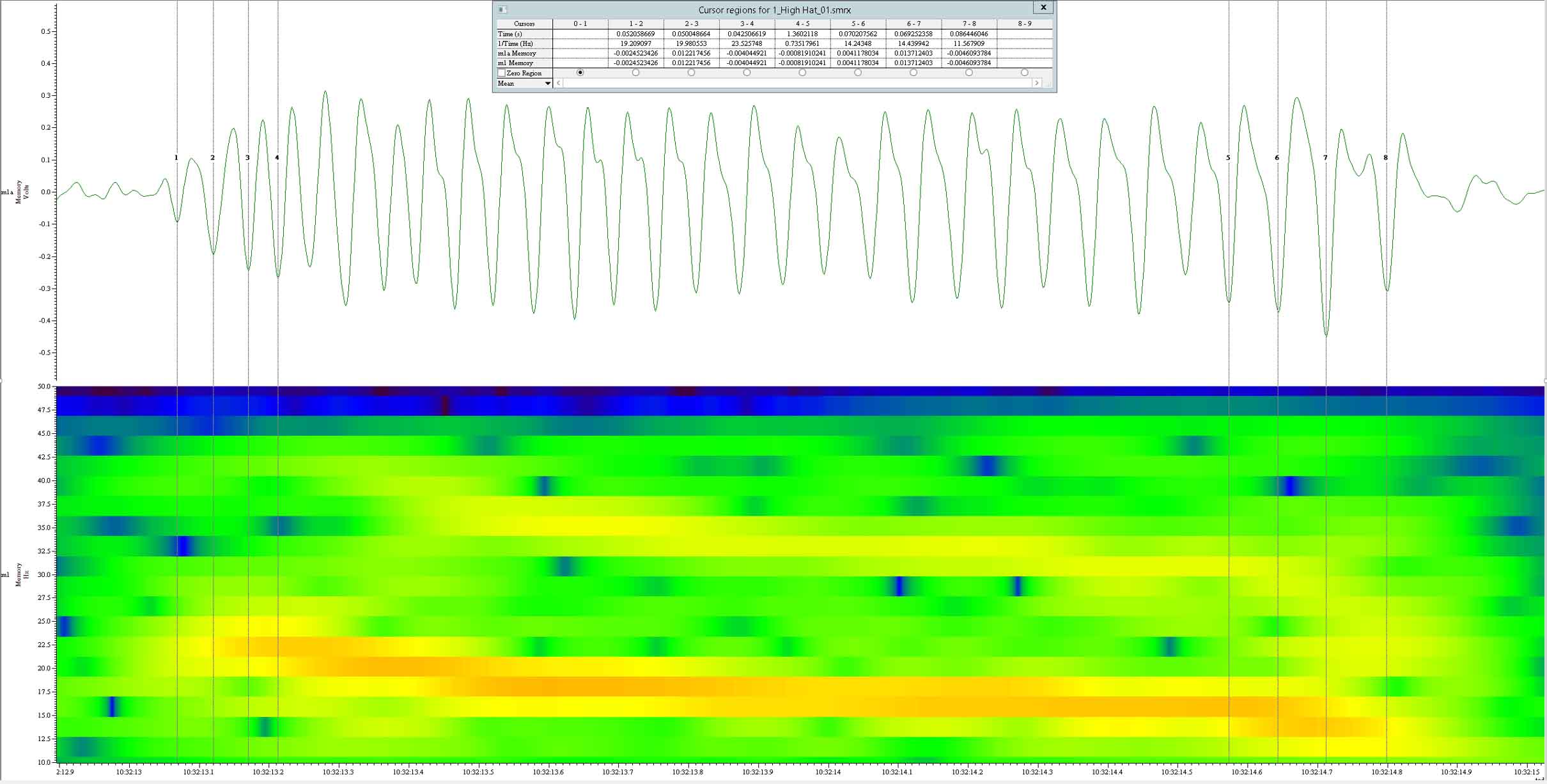  ESF signal trace + sonogram 